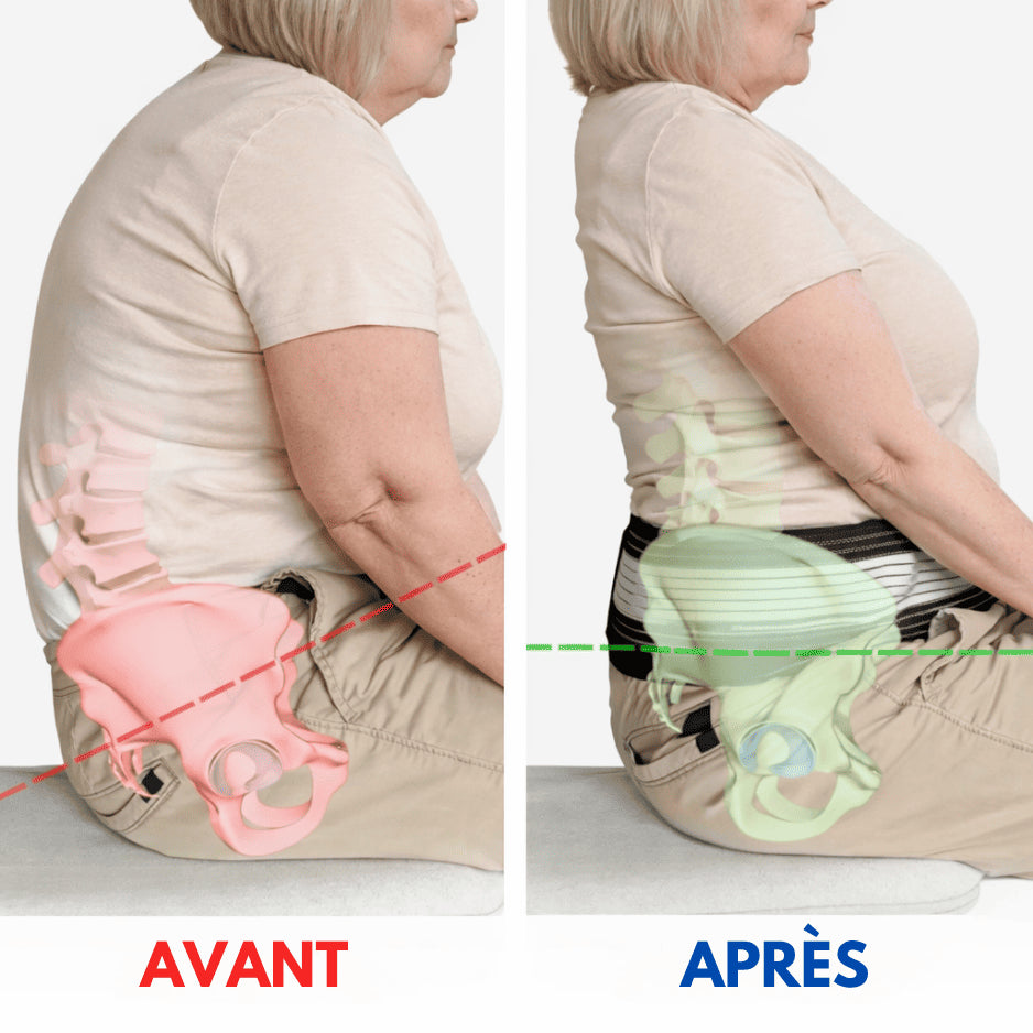 Orthostep™