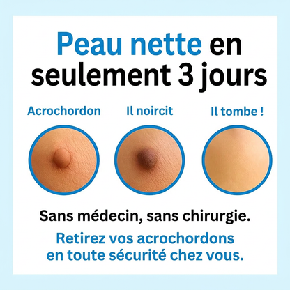 PureSkin Pro™ – Kit Anti-Excroissances | Peau Lisse Garantie en 4 Jours, Chez Vous