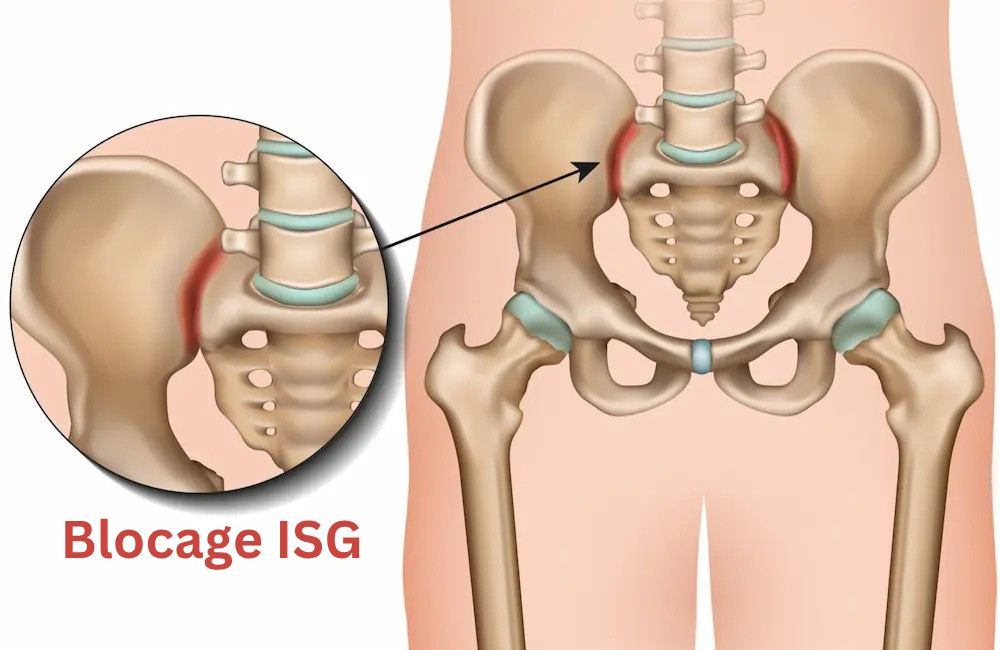 Alt Image